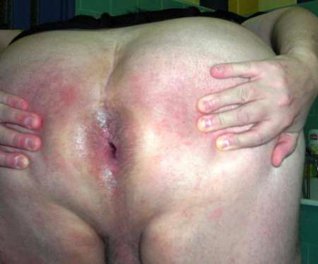 GAY PAS DE CALAIS PREPUCE GAY Jeune cul gay gay autour de moi